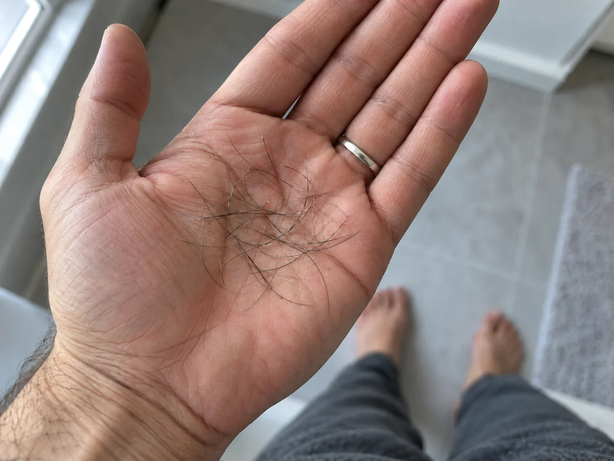 Hair loss over time